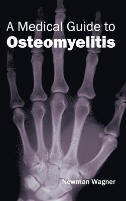 Medical Guide to Osteomyelitis 1