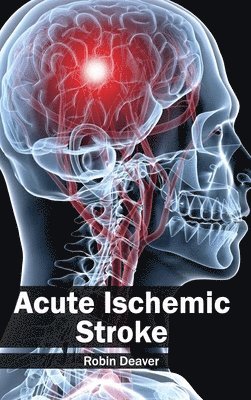 bokomslag Acute Ischemic Stroke