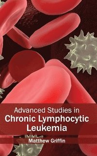 bokomslag Advanced Studies in Chronic Lymphocytic Leukemia