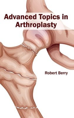 bokomslag Advanced Topics in Arthroplasty