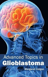 bokomslag Advanced Topics in Glioblastoma