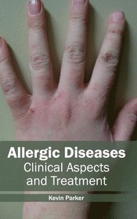 bokomslag Allergic Diseases: Clinical Aspects and Treatment