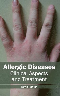 Allergic Diseases: Clinical Aspects and Treatment 1