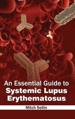 bokomslag Essential Guide to Systemic Lupus Erythematosus