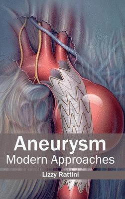 bokomslag Aneurysm: Modern Approaches