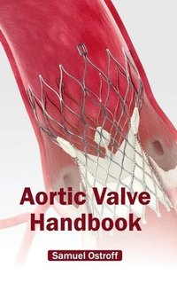 bokomslag Aortic Valve Handbook