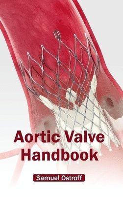 Aortic Valve Handbook 1