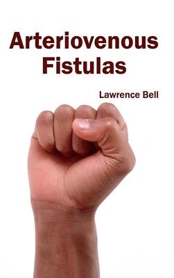 Lawrence Bell - Arteriovenous Fistulas, Inbunden