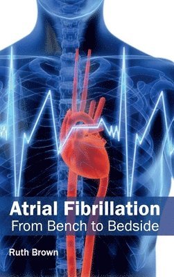 bokomslag Atrial Fibrillation: From Bench to Bedside