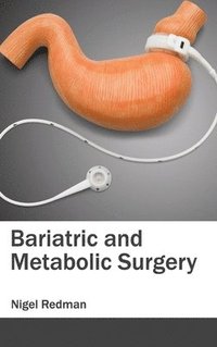 bokomslag Bariatric and Metabolic Surgery