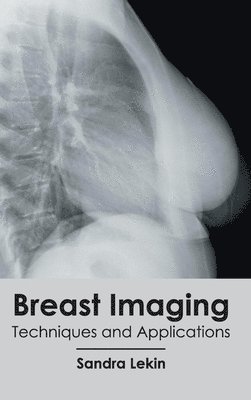 Sandra Lekin - Breast Imaging: Techniques and Applications, Inbunden
