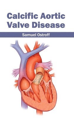 bokomslag Calcific Aortic Valve Disease