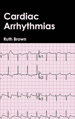 bokomslag Cardiac Arrhythmias