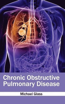 Michael Glass - Chronic Obstructive Pulmonary Disease, Inbunden