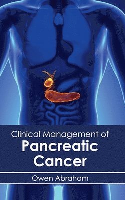 bokomslag Clinical Management of Pancreatic Cancer