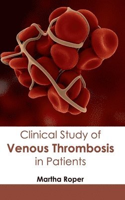 bokomslag Clinical Study of Venous Thrombosis in Patients