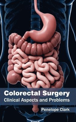 bokomslag Colorectal Surgery: Clinical Aspects and Problems