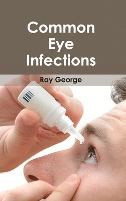 bokomslag Common Eye Infections