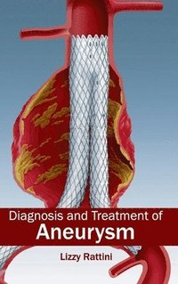 bokomslag Diagnosis and Treatment of Aneurysm