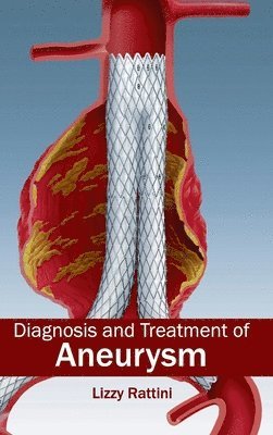 Diagnosis and Treatment of Aneurysm 1