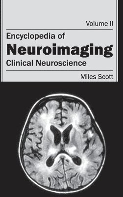 Encyclopedia of Neuroimaging: Volume II (Clinical Neuroscience) 1