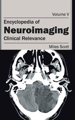 Encyclopedia of Neuroimaging: Volume V (Clinical Relevance) 1