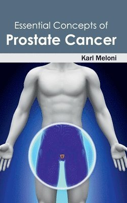 bokomslag Essential Concepts of Prostate Cancer