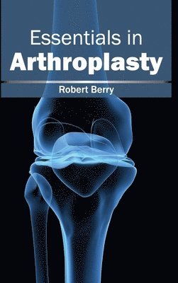 Robert Berry - Essentials in Arthroplasty, Inbunden