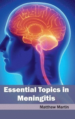 Matthew Martin - Essential Topics in Meningitis, Inbunden