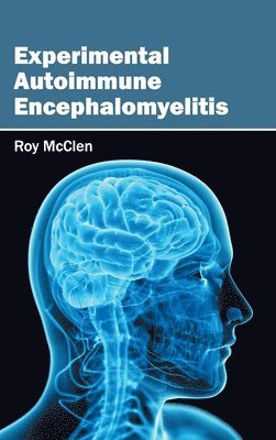 bokomslag Experimental Autoimmune Encephalomyelitis