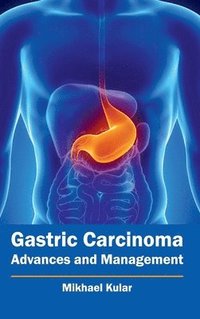 bokomslag Gastric Carcinoma: Advances and Management