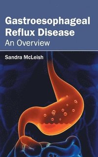 bokomslag Gastroesophageal Reflux Disease: An Overview