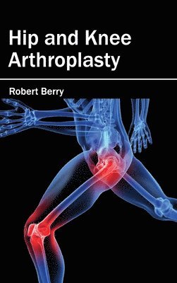 Robert Berry - Hip and Knee Arthroplasty, Inbunden