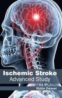 bokomslag Ischemic Stroke: Advanced Study