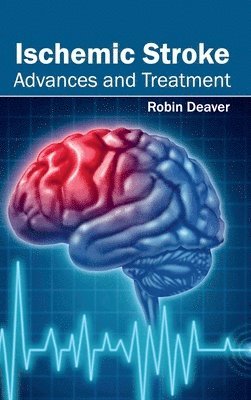 Ischemic Stroke: Advances and Treatment 1