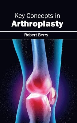 Key Concepts in Arthroplasty 1