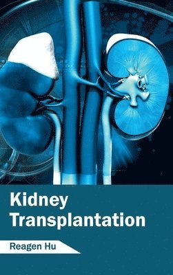 Reagen Hu - Kidney Transplantation, Inbunden