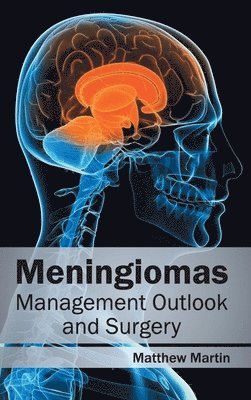 Matthew Martin - Meningiomas: Management Outlook and Surgery, Inbunden