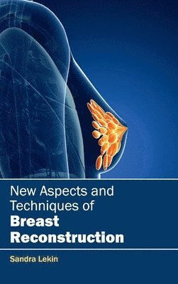 Sandra Lekin - New Aspects and Techniques of Breast Reconstruction, Inbunden