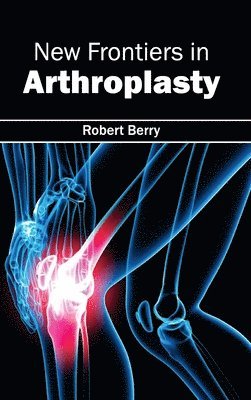 Robert Berry - New Frontiers in Arthroplasty, Inbunden
