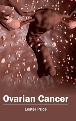 bokomslag Ovarian Cancer