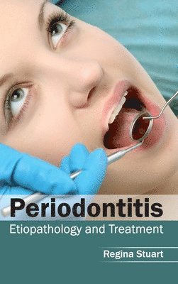 bokomslag Periodontitis: Etiopathology and Treatment