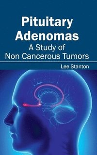 bokomslag Pituitary Adenomas: A Study of Non Cancerous Tumors