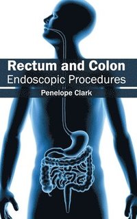 bokomslag Rectum and Colon: Endoscopic Procedures