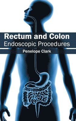 Rectum and Colon: Endoscopic Procedures 1