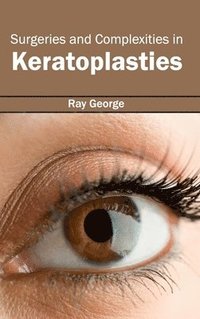 bokomslag Surgeries and Complexities in Keratoplasties