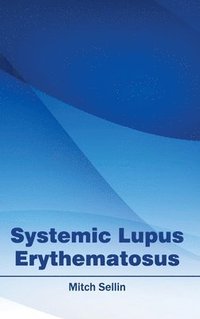 bokomslag Systemic Lupus Erythematosus