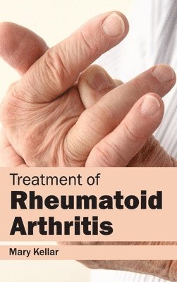 bokomslag Treatment of Rheumatoid Arthritis