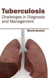 bokomslag Tuberculosis: Challenges in Diagnosis and Management