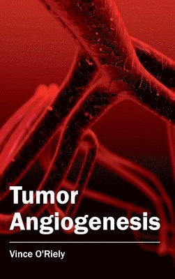 bokomslag Tumor Angiogenesis